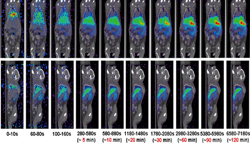 BG大游PET/CT分子影像手艺平台